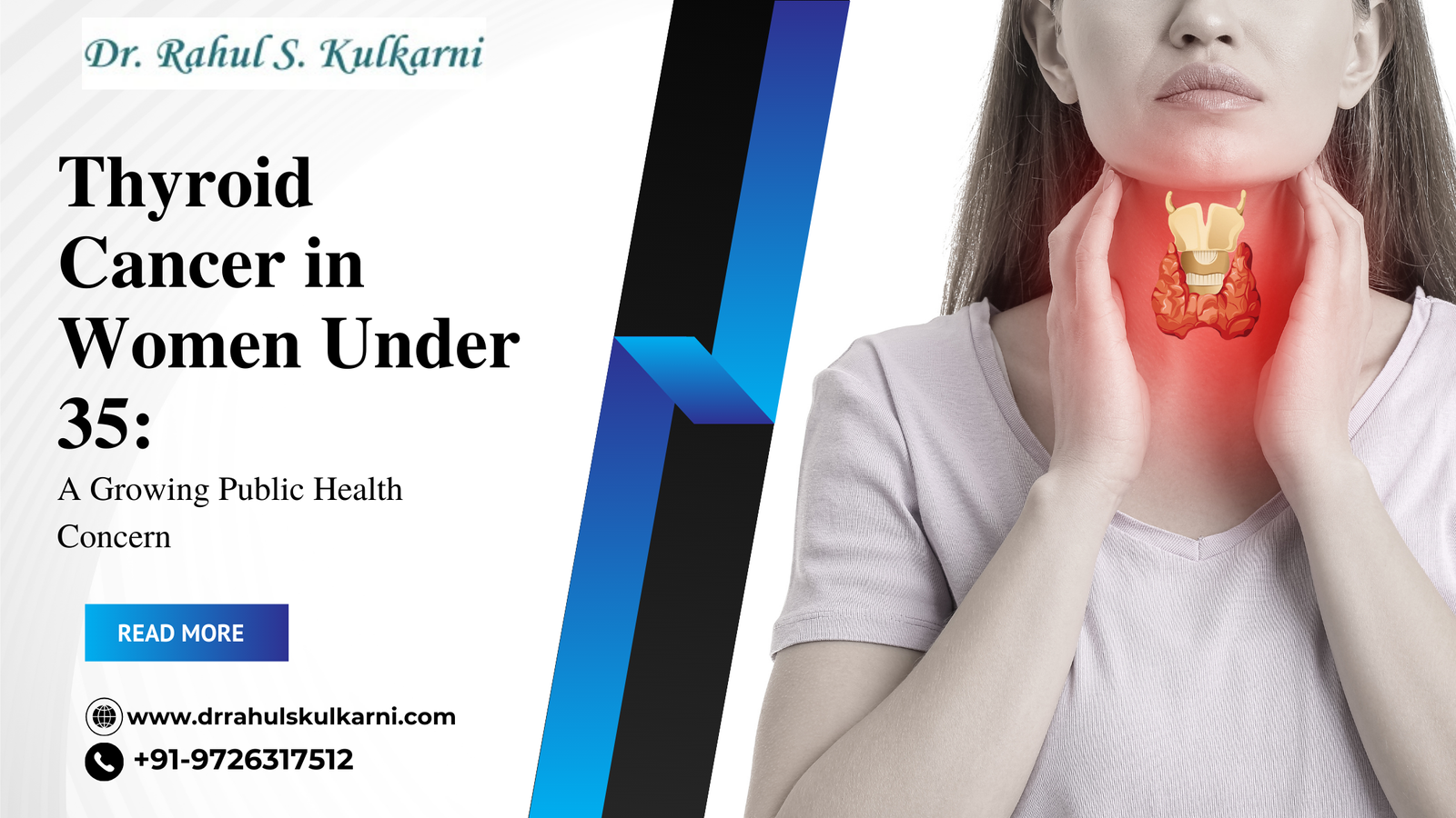 Thyroid Cancer in Women Under 35: A Growing Public Health Concern